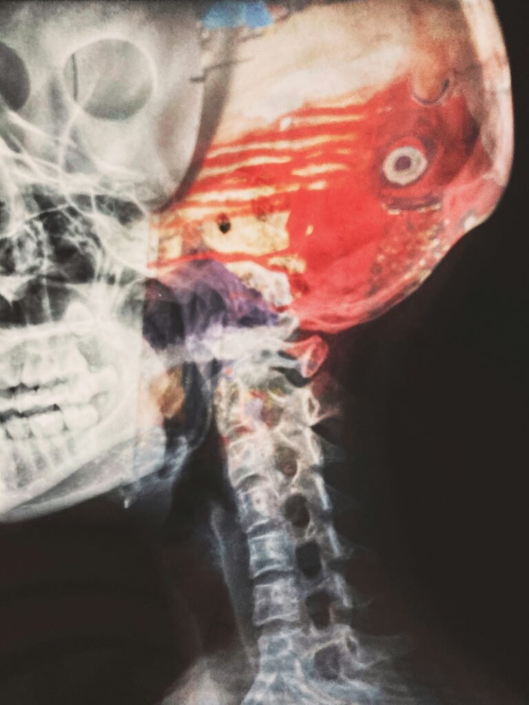 BRAIN GLYMPHATIC SYSTEM and NEURODEGENERATIVE CONDITIONS: A SYSTEM BY WHICH THE WASTING MOLECULE ARE REMOVED FROM THE VERTEBRATES BRAIN - Physiopathology     Paperback – January 6, 2022